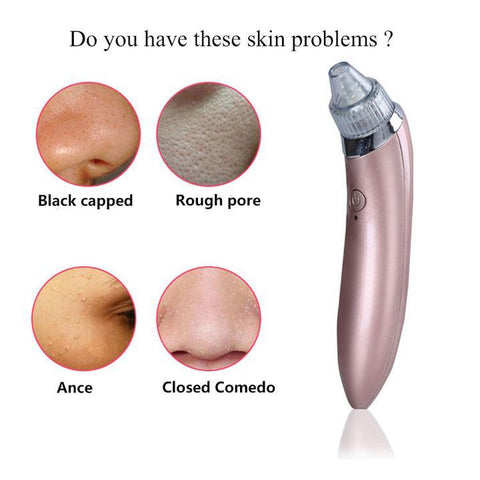 Image of Blackhead Remover Vacuum