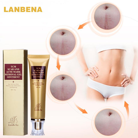 Image of Acne Scar Removal Cream