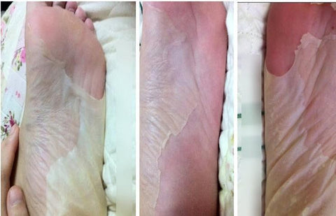 Image of Silky Feet - Deep Exfoliation Peel Socks